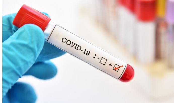 Новите случаи на коронавирус у нас са 1626 Починалите пациенти с COVID 19 са